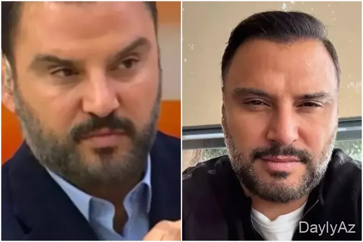 Alişan Botoks etdirdiyini belə etiraf etdi – FOTO