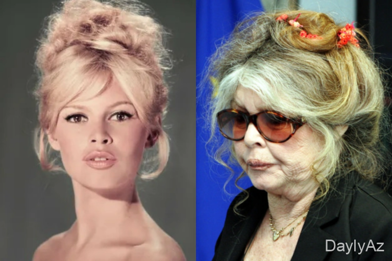 Məşhur franse aktrisanın ölüm səbəbi müəyyənləşdirdi