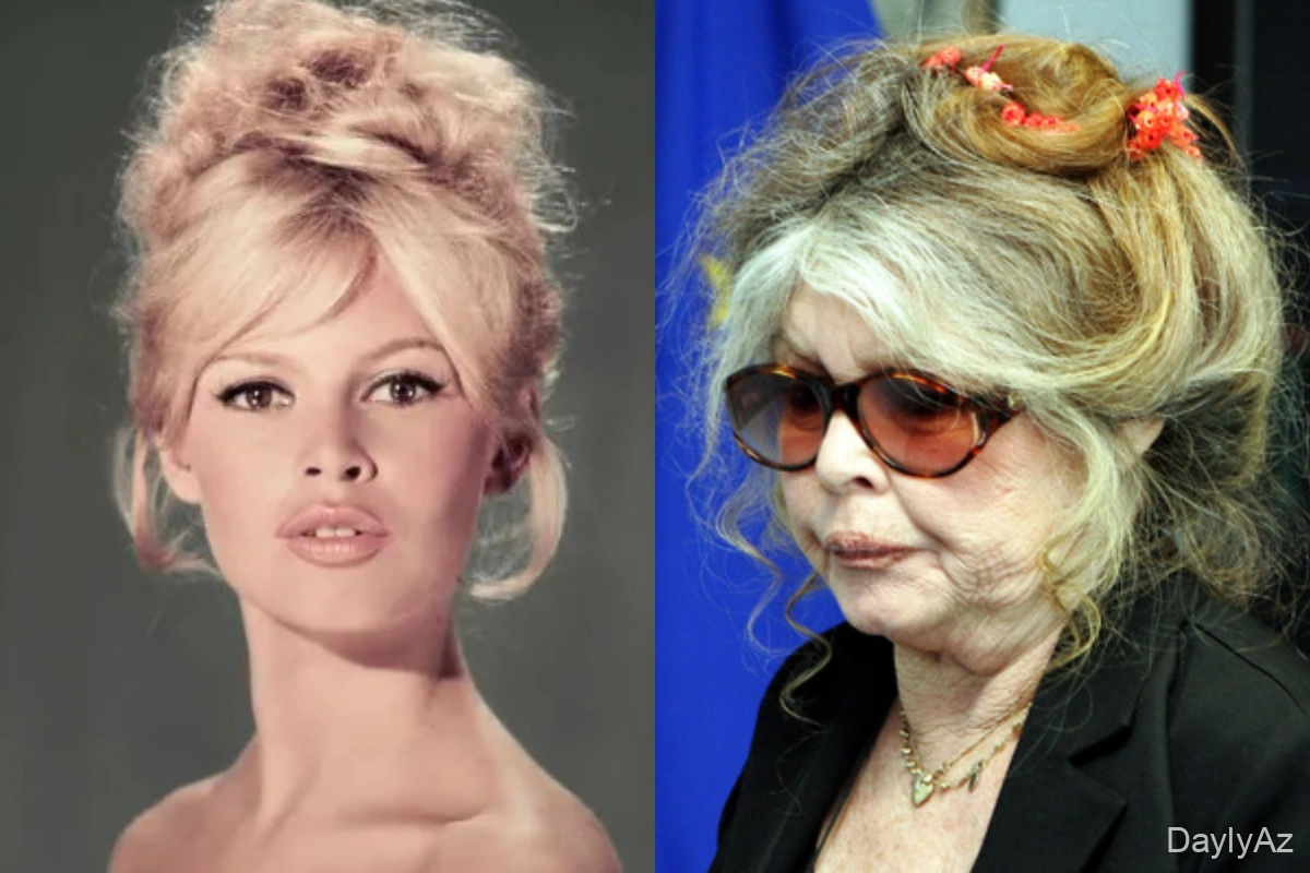 Məşhur franse aktrisanın ölüm səbəbi müəyyənləşdirdi