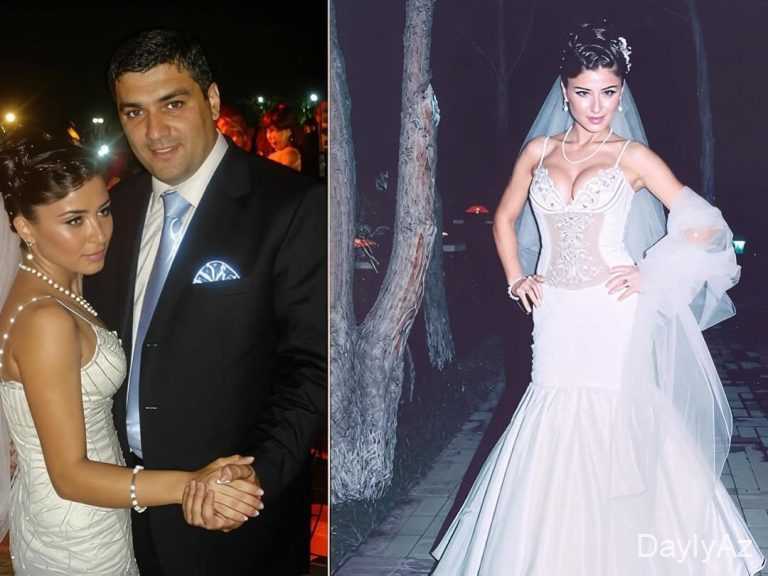 Azərbaycanlı məşhurların toy FOTOları müzakirə yaratdı