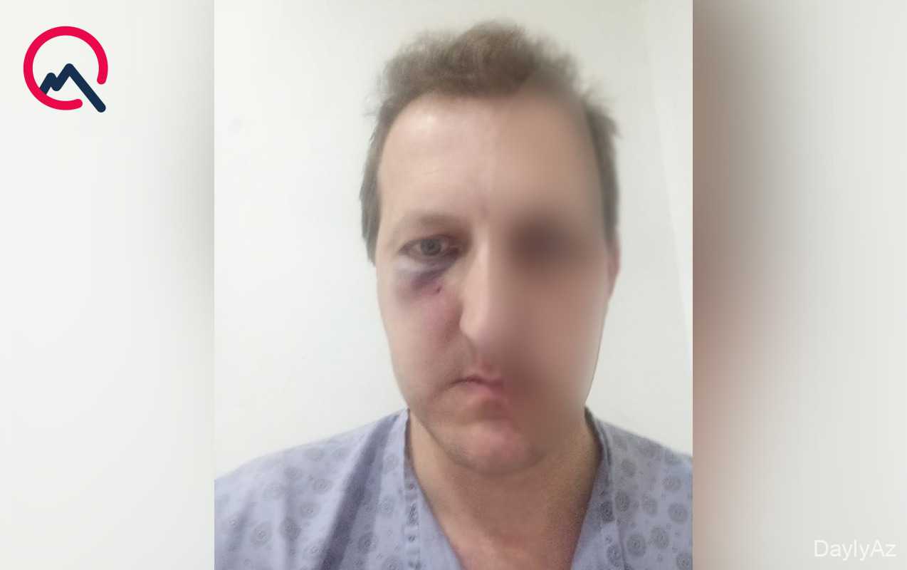 Bakıda Xalq Artist Ailəsinin Oğlunu Döyənlər