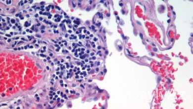 toxumalar haqqinda umumi melumat