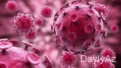 it xestelikleri haqqinda melumat