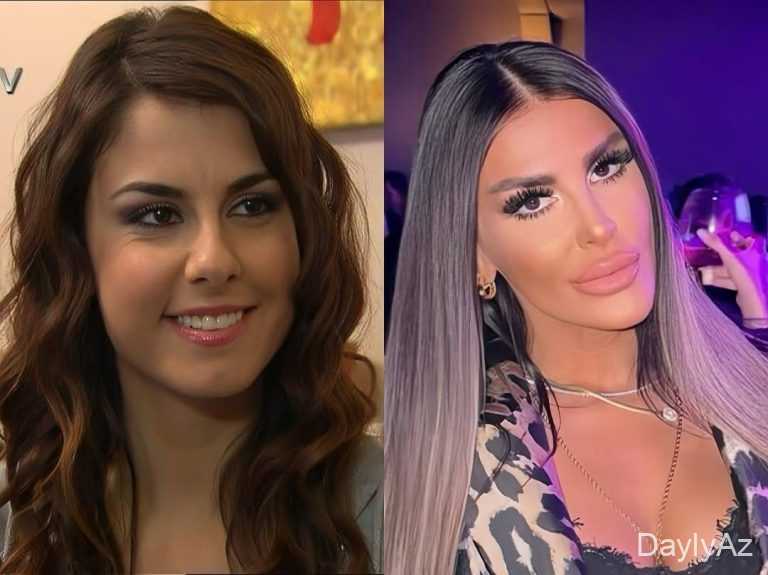 "Adanalı"nın Pınarı tanınmaz halda – FOTO