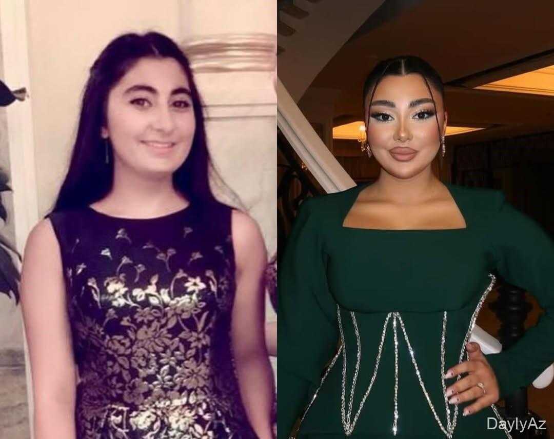 Azərbaycanlı Bloqerlərin 10 İldə Görünüşündəki Dəyişikliklər Diqqət Çəkdi – FOTOlar