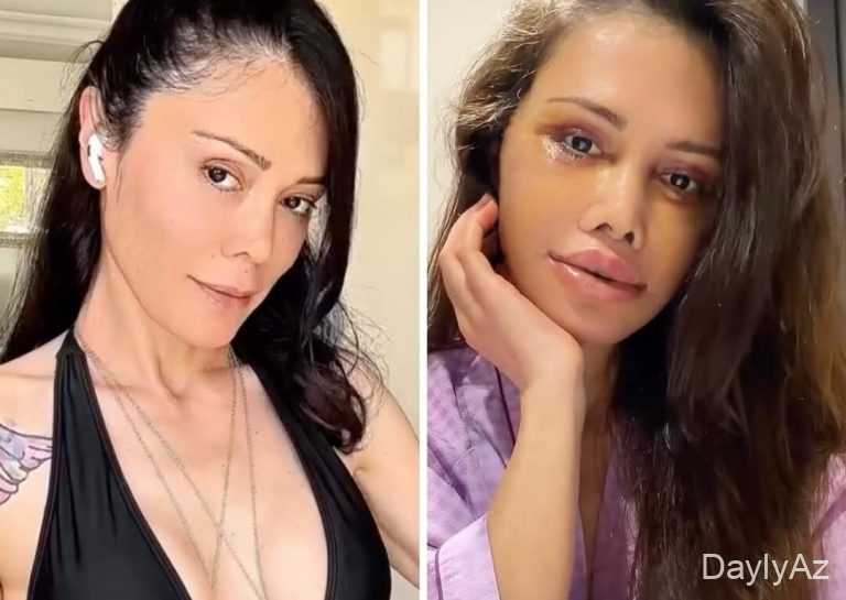 Yenidən Şəkil Dəyişərək Gündəmə Gələn – FOTO