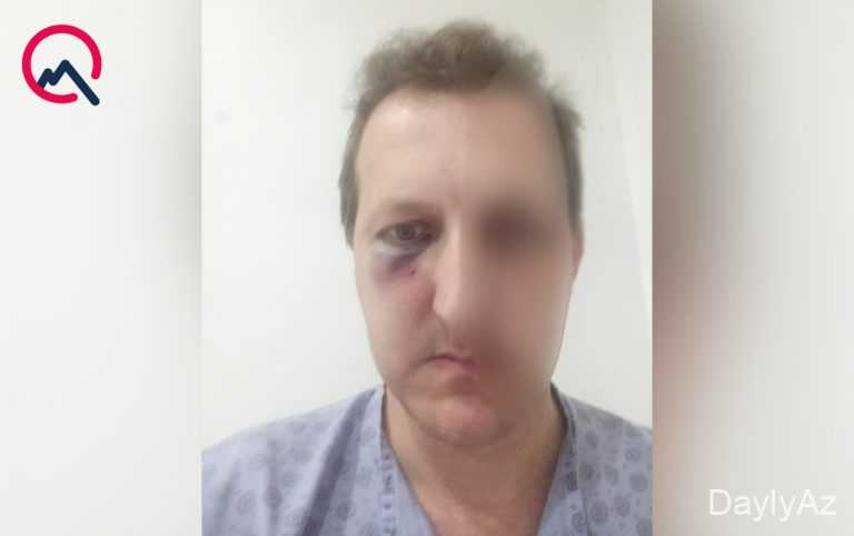 Xalq artistinin oğlunun evə buraxılması