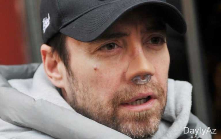 Əsəriləri ilə məşhur müğənni 13-cü dəfə burun əməliyyatı keçirdi – FOTO