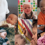 Down Sindromu Nədir? Səbəbləri, Əlamətləri və Müalicə Yolları