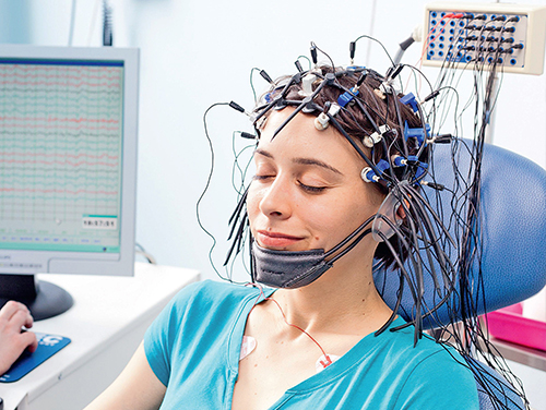 EEG nədir? Elektroensefaloqrafiya müayinəsi, istifadəsi və nəticələri