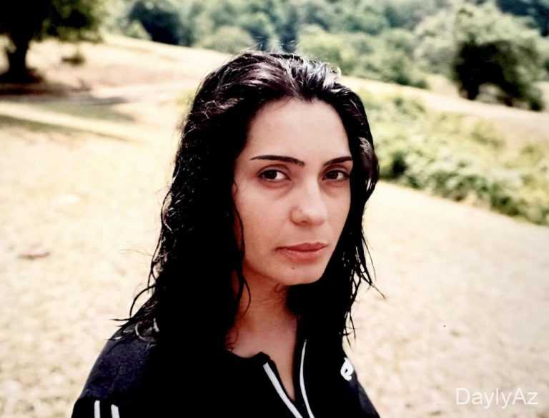 Əməkdar artistə ağır İTKİ – FOTO