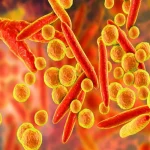 Mycoplasma hominis nədir? Əlamətləri, yoluxma yolları və müalicəsi