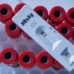 HBsAg Nədir? – Hepatit B Antigeni və Diaqnostikası