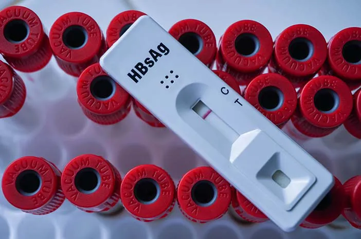 HBsAg Nədir? – Hepatit B Antigeni və Diaqnostikası