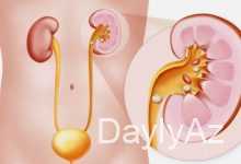 sidik kisesi haqqinda melumat