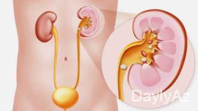 sidik kisesi haqqinda melumat