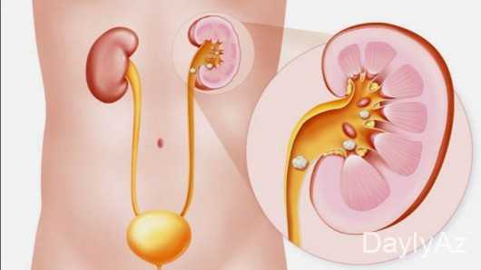 sidik kisesi haqqinda melumat